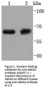 Anti-ABCG2 Antibody