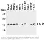 Anti-IL-21 Antibody