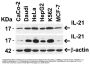 Anti-IL-21 Antibody