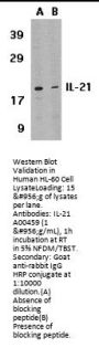 Anti-IL-21 Antibody