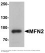 Anti-Mitofusin-2 MFN2 Antibody