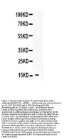Anti-Leptin Antibody Picoband®