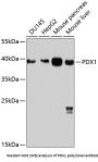 Anti-PDX1 Antibody