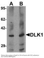 Anti-Protein delta homolog 1 DLK1 Antibody
