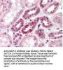 Anti-NOTCH 2 Antibody