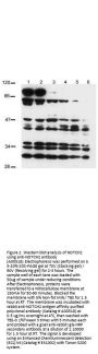 Anti-NOTCH 2 Antibody