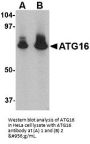 Anti-ATG16 ATG16L1 Antibody