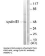 Anti-Cyclin E1 CCNE1 Antibody