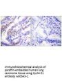 Anti-Cyclin E1 CCNE1 Antibody