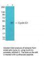 Anti-Cyclin E1 CCNE1 Antibody