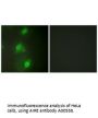 Anti-AIRE/Aire 1 Antibody