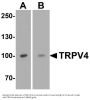 Anti-TRPV4 Antibody