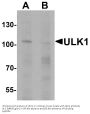 Anti-ULK1 Antibody