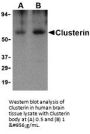 Anti-Clusterin Antibody