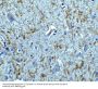 Anti-Clusterin Antibody
