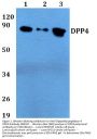 Anti-Dipeptidyl peptidase 4 DPP4 Antibody