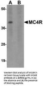 Anti-Melanocortin receptor 4 MC4R Antibody