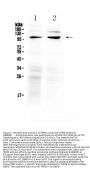 Anti-TRPC6 Antibody Picoband®