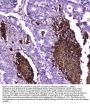 Anti-Lactoferrin/LTF Antibody Picoband®
