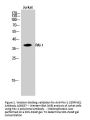 Anti-PAI-1 SERPINE1 Antibody