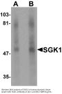 Anti-SGK1 Antibody