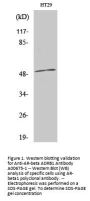 Anti-AR-beta ADRB1 Antibody