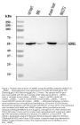 Anti-ADRB1 Antibody Picoband®