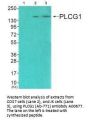 Anti-PLCG1 (Ab-771) Antibody