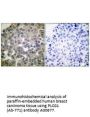 Anti-PLCG1 (Ab-771) Antibody