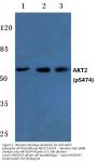 Anti-AKT2 (phospho-S474) Antibody