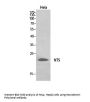 Anti-Neurotensin NTS Antibody
