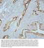 Anti-MMP1 Antibody Picoband®