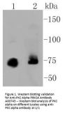 Anti-PKC Alpha PRKCA Antibody