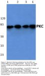 Anti-PKC-pan (T495) PRKCA Antibody