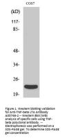 Anti-TNF-beta LTA Antibody