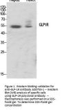 Anti-GLP-1R Antibody