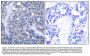 Anti-Zap-70 (Ab-319) Antibody