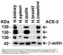 Anti-ACE2 Antibody