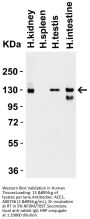 Anti-ACE2 Antibody