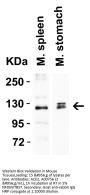 Anti-ACE2 Antibody