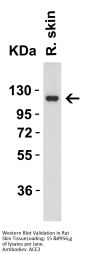 Anti-ACE2 Antibody