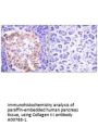 Anti-Collagen III COL3A1 Antibody