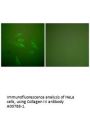 Anti-Collagen III COL3A1 Antibody