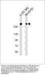 Anti-Nestin Antibody (S1409)