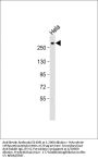 Anti-Nestin Antibody (S1409)