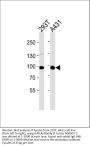 Anti-IL4R Antibody (C-term)