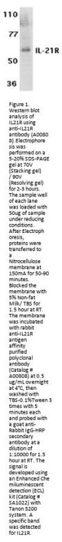 Anti-IL-21R (ED) Antibody