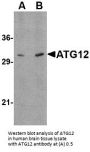 Anti-Ubiquitin-like protein ATG12 ATG12 Antibody