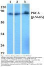 Anti-PKC Delta (phospho-S645) PRKCD Antibody