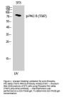Anti-Phospho-PKC delta (T507) PRKCD Antibody